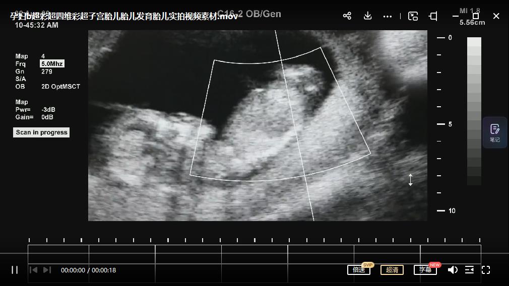 《无人直播胎教助眠项目》轻松引爆直播间，教程+软件+素材